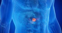 El cáncer de páncreas es uno de los más letales y resistentes a los tratamientos. Nuevas investigaciones apuntan a prolongar la supervivencia de los pacientes tras décadas sin avances significativos. FOTO AFP