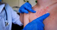 Se trata de jóvenes entre los 28 y 35 años que habían viajado recientemente al exterior. Foto: GETTY