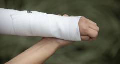 En lo corrido de este año, de los 81 quemados que van en Antioquia, 24 corresponden a menores de edad. FOTO: Edwin Bustamante