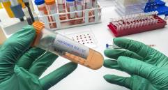 El Centro Médico de la Universidad de Nebraska validó en 48 horas la única prueba PCR disponible en EE. UU. para detectar el virus de los Andes en fases tempranas. FOTO Science Photo Library via AFP