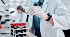 El prototipo de test desarrollado permite detectar en sangre el biomarcador sAXL, asociado al cáncer de páncreas, mediante una tira reactiva de bajo coste. FOTO: GETTY