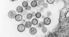 Hantavirus visto a microscopía. FOTO agencia Sinc/CDC/Brian W.J. Mahy, PhD; Luanne H. Elliott, M.S.