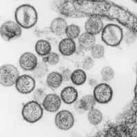 Hantavirus visto a microscopía. FOTO agencia Sinc/CDC/Brian W.J. Mahy, PhD; Luanne H. Elliott, M.S.