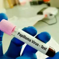 La mayoría de las personas que tienen el virus del papiloma humano no presentan síntomas. FOTO: OPS