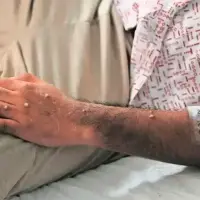 La Secretaría de Salud hizo un llamado a la ciudadanía a mantener la calma, evitar la desinformación y seguir las recomendaciones oficiales. FOTO: OMS.