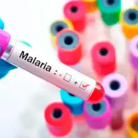 La malaria es una enfermedad tropical transmitida por un mosquito. FOTO SSTOCK