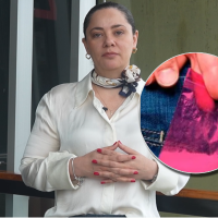 La secretaria de Salud, Natalia López Delgado, alertó que ya van 18 casos en el Valle de Aburrá y pidió a los médicos hacer vigilancia epidemiológica. Foto: cortesía.