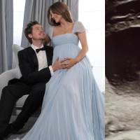 Barbara Palvin y Dylan Sprouse sorprendieron en Cannes 2026 al revelar que se convertirán en padres por primera vez. FOTO: Redes sociales de Barbara Palvin y Dylan Sprouse.