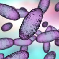 La peste neumónica es la forma más peligrosa de la peste, una enfermedad infecciosa causada por la bacteria Yersinia pestis que puede transmitirse por vía aérea de persona a persona y matar en menos de 24 horas sin tratamiento. FOTO Science Photo Library via AFP