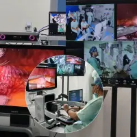 La cirugía a distancia se hizo gracias a un robot y a una conexión satelital de internet además de un apoyo de médicos indios que estaban preparados en caso de alguna falla en la conectividad. Foto: Captura videos redes sociales. 