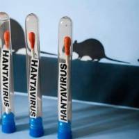 España se une a Reino Unido, Francia, Suiza, Sudáfrica y Estados Unidos como las naciones con casos positivos de hantavirus. Fotos: AFP