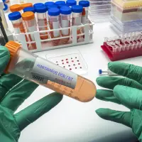 El Centro Médico de la Universidad de Nebraska validó en 48 horas la única prueba PCR disponible en EE. UU. para detectar el virus de los Andes en fases tempranas. FOTO Science Photo Library via AFP