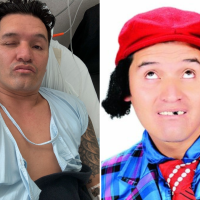 El comediante compartió en sus redes sociales una imagen hospitalizado. Foto: Redes sociales y Archivo. 