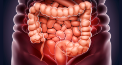 La exposición a bacterias productoras de colibactina en la infancia podría explicar el aumento de cáncer colorrectal en jóvenes. FOTO Pixabay