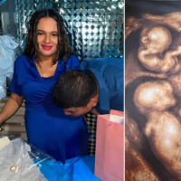 María Tapia y Jonatan Zapa esperan cuatrillizos idénticos. Foto: tomada de TikTok @cuatrillizoscaucasia