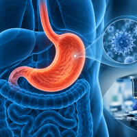 Los investigadores estudiaron el tejido tumoral de distintos pacientes en Antioquia para caracterizar un subtipo de cáncer gástrico. Foto: imagen ilustrativa generada por IA.
