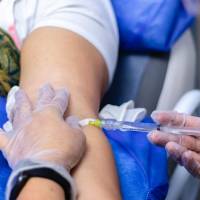 Esta etapa del estudio se centrará en el Donanemab, ya aprobado en EE. UU. y probado en pacientes con síntomas, y el RG6289 que aún está en fase de evaluación de la eficacia. FOTO: UDEA