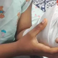 La mayoría de quemaduras se reportan en el rostro, brazos y piernas. Las autoridades realizaron un llamado a los padres de familia para evitar la manipulación de artefactos como chispitas mariposas o voladores. FOTO: Coprensa/El País