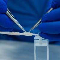 El neurotubo bioabsorbible busca reemplazar los injertos en lesiones de nervios periféricos. FOTO cortesía Ruta n