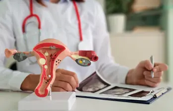 En 1860 se documentó el primer caso de endometriosis en el mundo. Foto Getty.