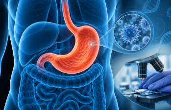 Los investigadores estudiaron el tejido tumoral de distintos pacientes en Antioquia para caracterizar un subtipo de cáncer gástrico. Foto: imagen ilustrativa generada por IA.
