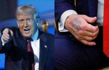 Donald Trump, de 79 años, respondió a las dudas sobre su salud tras la difusión de imágenes que mostraban moretones en su mano derecha. FOTO: Getty Images, redes sociales. 