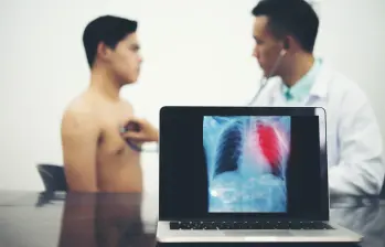 La tuberculosis sigue siendo un reto de salud pública, con miles de casos reportados en Colombia. Foto: Getty