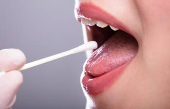 Método experimental con saliva puede predecir su riesgo de padecer alzhéimer en el futuro