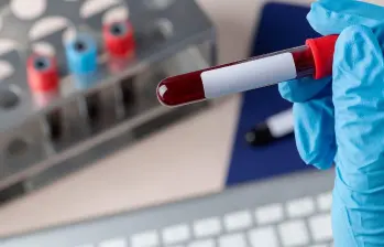 El prototipo de test desarrollado permite detectar en sangre el biomarcador sAXL, asociado al cáncer de páncreas, mediante una tira reactiva de bajo coste. FOTO Agencia Sinc