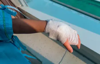 Las manos son la extremidad más afectada por la manipulación de pólvora en Antioquia, con 13 casos. FOTO: GETTY