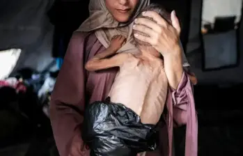 La Organización Mundial de la Salud afirma que 148 personas murieron de desnutrición en Gaza desde enero de 2025. FOTO: Ahmed al-Arini, Getty