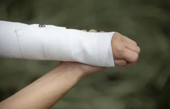 En lo corrido de este año, de los 81 quemados que van en Antioquia, 24 corresponden a menores de edad. FOTO: Edwin Bustamante