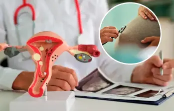 Histórico: por primera vez Corte permite reversar ligadura de trompas en Colombia. Foto: Getty