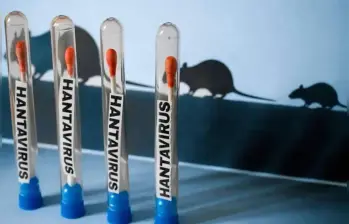 España se une a Reino Unido, Francia, Suiza, Sudáfrica y Estados Unidos como las naciones con casos positivos de hantavirus. Fotos: AFP