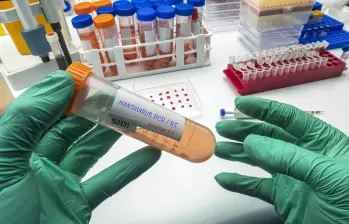 El Centro Médico de la Universidad de Nebraska validó en 48 horas la única prueba PCR disponible en EE. UU. para detectar el virus de los Andes en fases tempranas. FOTO Science Photo Library via AFP
