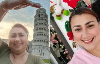Yulixa Toloza se sometió a un procedimiento estético el pasado 13 de mayo. Foto: TikTok @yulixa.toloza