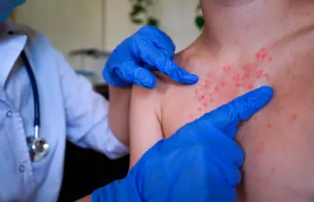 Se trata de jóvenes entre los 28 y 35 años que habían viajado recientemente al exterior. Foto: GETTY