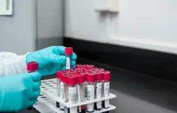 La nueva prueba en sangre podría facilitar el diagnóstico temprano de distintos tipos de cáncer. FOTO Pixabay