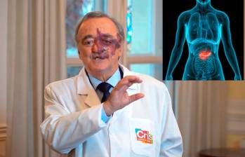 El estudio fue realizado por el Grupo de Oncología Experimental del Centro Nacional de Investigaciones Oncológicas (CNIO) de España. Foto captura de video y Depositphotos.