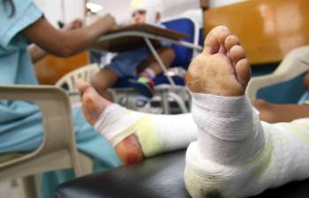 Durante el último año, por lo menos 20 menores de edad han resultado lesionados por el uso de pólvora en Antioquia. FOTO: Donaldo Zuluaga Velilla. Archivo El Colombiano