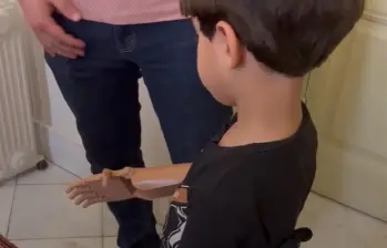 Niños en Gaza reciben prótesis impresas en 3D gracias a la ONG española Ayúdame3D, que trabaja con aliados locales para diseñarlas y enviarlas gratuitamente. FOTO cortesía AYÚDAME3D