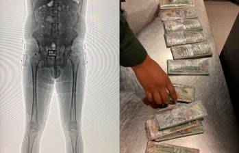 Con la revisión por body scan se le encontró a un hombre miles de dólares entre su ropa interior. FOTO: CORTESÍA