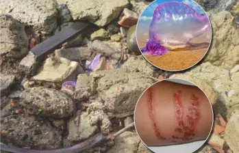 La fragata portuguesa fue avistada en las playas de Necoclí. En detalle, su apariencia y las lesiones que provoca su contacto. Fotos: Corporurabá, CVS y cortesía.