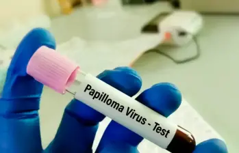 La mayoría de las personas que tienen el virus del papiloma humano no presentan síntomas. FOTO: OPS