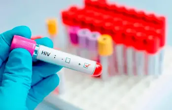 El virus de inmunodeficiencia humana (VIH) es una enfermedad que ataca al sistema inmunitario del cuerpo y no tiene cura. FOTO: Getty
