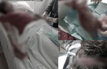 Doña Orfilia sufrió lesiones en el brazo izquierdo, con amputación de un dedo; así como mordeduras en la cabeza y en la cara. FOTOS: CORTESÍA
