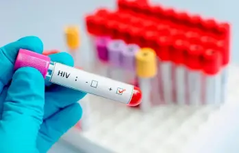 Se estima que 9 millones de personas en todo el mundo carecen de acceso a tratamientos vitales contra el VIH, y las nuevas infecciones siguen aumentando en varias regiones. FOTO GETTY
