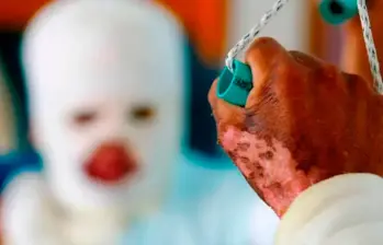 Dos de las personas resultaron con heridas de tercer grado, significa que muy seguramente quedarán con secuelas permanentes. FOTO: ARCHIVO EL COLOMBIANO