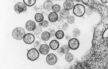 Hantavirus visto a microscopía. FOTO agencia Sinc/CDC/Brian W.J. Mahy, PhD; Luanne H. Elliott, M.S.