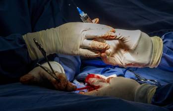 Imagen de referencia de una cirugía de transplante de órganos. FOTO: JULIO CÉSAR ECHEVERRI